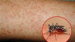 Chuyên gia chỉ cách ngăn muỗi gây bệnh sốt xuất huyết