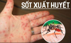 Cả nước có hơn 149.500 ca sốt xuất huyết, Hà Nội ghi nhận thêm tuýp D3 gây bệnh