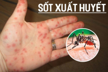 Ghi nhận 61.799 ca mắc sốt xuất huyết, muỗi gây bệnh này có thể bay xa bao nhiêu?
