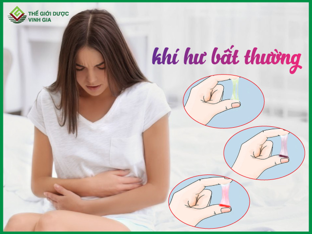 Khí hư bất thường là như thế nào?