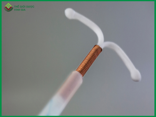 Đặt vòng là phương pháp tránh thai phổ biến được chị em ưa dùng