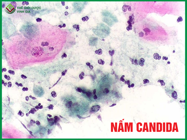 Hình ảnh nấm Candida