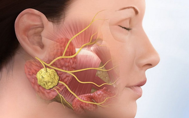 Viêm tuyến nước bọt mang tai thường diễn biến lành tính.