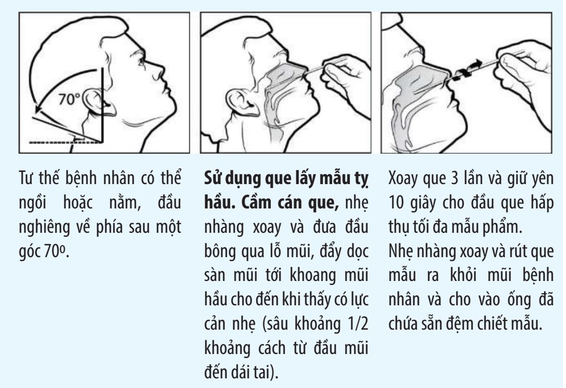 Hướng dẫn lấy mẫu dịch tỵ hầu